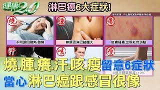 燒.腫.癢.汗.咳.瘦留意6大症狀 當心淋巴癌跟感冒很像  健康2.0