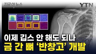 금 간 뼈에 붙이세요...'뼈 반창고' 놀라운 신소재 개발 [지금이뉴스] / YTN