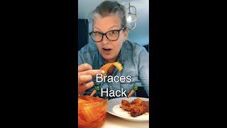 Orthodontist Reacts: Can You Eat Carrots With Braces?  #shorts