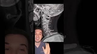 What’s wrong with this cervical spine X-ray?