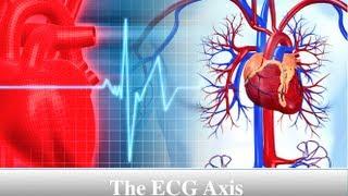 ECG Axis Tutorial: Part 4 - The Quadrant Method