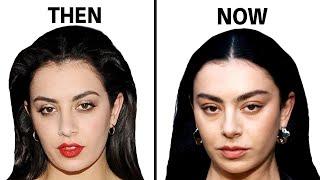 Charli XCX Plastic Surgery: Transparency Queen or Not?