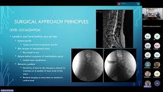 Decompression Techniques : James Bruffey, MD