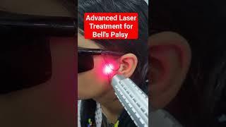 Advanced Laser Treatment for Bell's Palsy @myhomephysio2M  Dr.Pravin Singh Physiotherapist