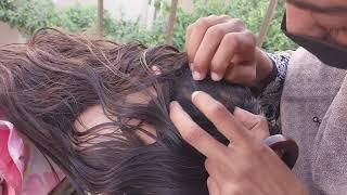 Nitpicking ASMR scalp close-up view carikutu piolhos video103