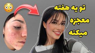 * clear skin *بدون هزینه پوستتو مثل پوست بچه کن