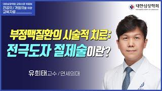 부정맥질환의 시술적 치료: 전극도자 절제술이란?