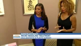 CAPS Micro Needling Featured on Good Day Marketplace