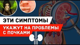 КАК РАСПОЗНАТЬ ЗАБОЛЕВАНИЯ ПОЧЕК? | Главные симптомы