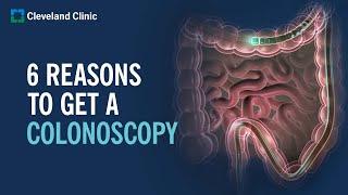 6 Reasons to Get a Colonoscopy