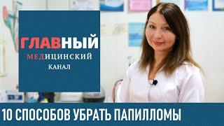 Как убрать Папилломы. 10 способов в домашних условиях. Лечение папиллом народными средствами