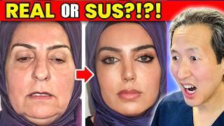 INSANE Turkish Cosmetic Surgery Results! Real or SUS?