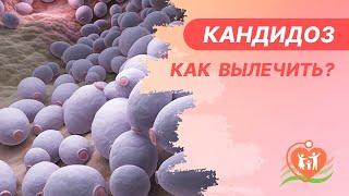   Кандидоз - как вылечить?