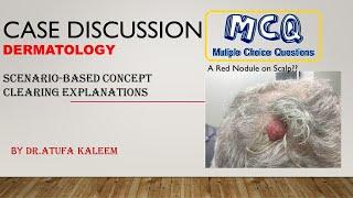 Case Discussion |Dermatology | Practice Questions | Dr Atufa Kaleem | epidermal nevus | medical