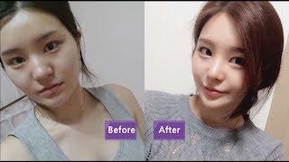 JW Plastic Surgery, the best Korean plastic surgery clinic in Seoul