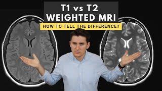 T1 vs T2 weighted MRI images: How to tell the difference