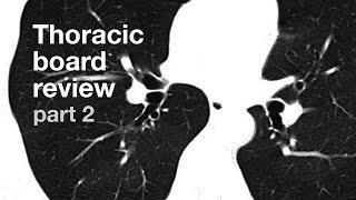 Board Review | Thoracic Radiology | Part 2