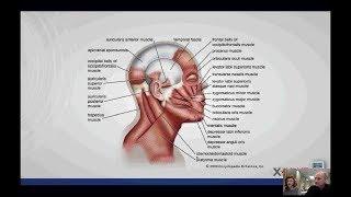 Treating headaches with the Stimpod NMS460 - Webinar - 26 September 2017