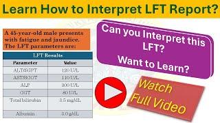 Interpret Liver Function Test Easily: SGOT, SGPT, ALP, Bilirubin, Albumin, PT/INR