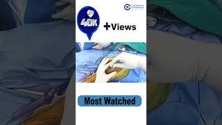 Total Knee Replacement Explained by Dr. Apurv Mehra