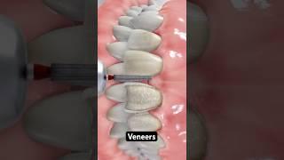 The celebrity secret to perfect teeth (3D Animation)