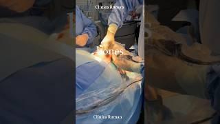 Cirurgia e Traumatologia Bucomaxilofacial Clínica Ruman