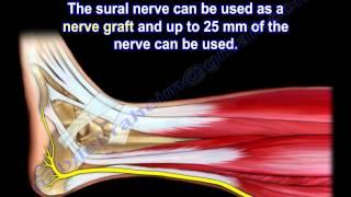 Sural Nerve Anatomy - Everything You Need To Know - Dr. Nabil Ebraheim