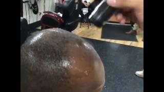 Hair Illusion Applied on Bald Head