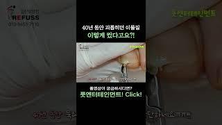 40년동안 괴롭히던 이물질... 이렇게 컸다고요..?? #레푸스 #일산레푸스 #내성발톱 #무좀발톱 #ingrown_toenail #일산내성발톱 #일산무좀발톱 #발톱