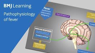 Pathophysiology of fever explained