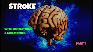 HOW TO PREVENT STROKE | Types, Causes, Symptoms and Prevention of stroke (part1) | INTELLECT MEDICOS