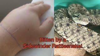 Sidewinder Rattlesnake Bite