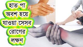 হাত পা অবশ হয়ে যাওয়া যেসব রোগের লক্ষণ জানেন কি?