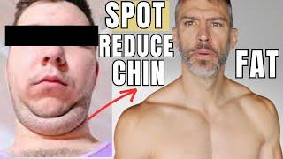 Double Chin Fat Gone | No Surgery | Stubborn Fat Loss