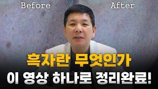 검버섯, 흑자 홈케어로 없앨 수 있을까?? #흑자제거 #검버섯 #여드름흉터