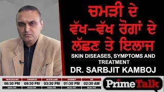 Prime Talk #66_DR.Sarbjit Kamboj-Skin Diseases,Symptoms And Treatment