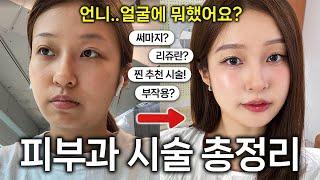 피부과 시술 & 얼굴 관리 총정리 돈 절대 안 아까운! 추천 vs 비추천? 홈케어 꿀템? 망한 부작용썰...