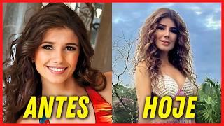 15 FAMOSOS BRASILEIROS QUE EXAGERARAM NA HARMONIZAÇÃO FACIAL! 