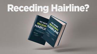 How to Fix Receding Hairline ( No More Receding Hairline)