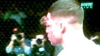 BJ penn splits open diego sanchez.wmv