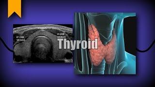 Thyroid Ultrasound