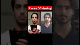 5 years of #mewing