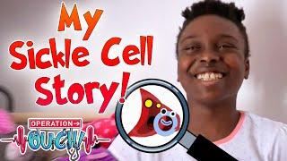 Bolu's Sickle Cell Anaemia Story 🩸 | Ouch Patients | Operation Ouch