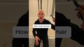 I'm a girl that's bald #funny #shortsfeed #viralvideos #viralshort #comedy #shortsviral #fypシ゚viral