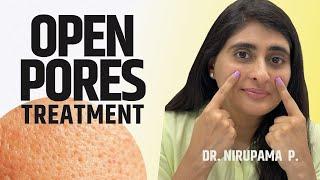 Open Pores | Open Pores Treatment| Open Pores video| Open Pores cream  (2024)