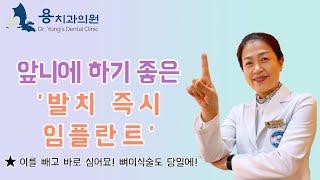 [인천 용치과의원] 잘 보이는 앞니에 임플란트를 해야 한다면? 발치 즉시 임플란트 수술!