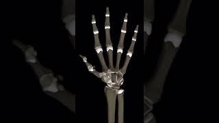 MCP Joint Arthritis | Demonstration #varanasi #orthopaedicdoctor #arthritis #hand