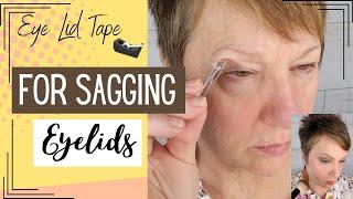 Eyelid tape, does it work?