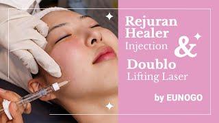 Rejuran Healer Injection and Doublo Lifting Laser | How It's Like | Before & After  | Eunogo Beauty