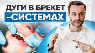 Дуги в брекет-системах: виды, цены, установка. Современная ортодонтия